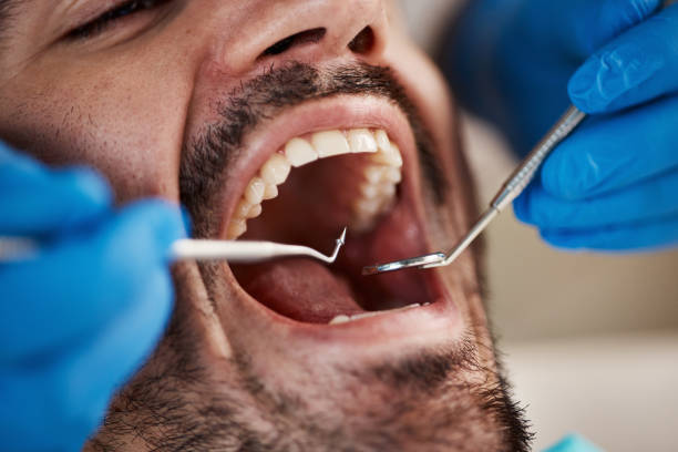 Best Emergency Treatment for Dental Infections or Abscesses in Apple Creek, OH